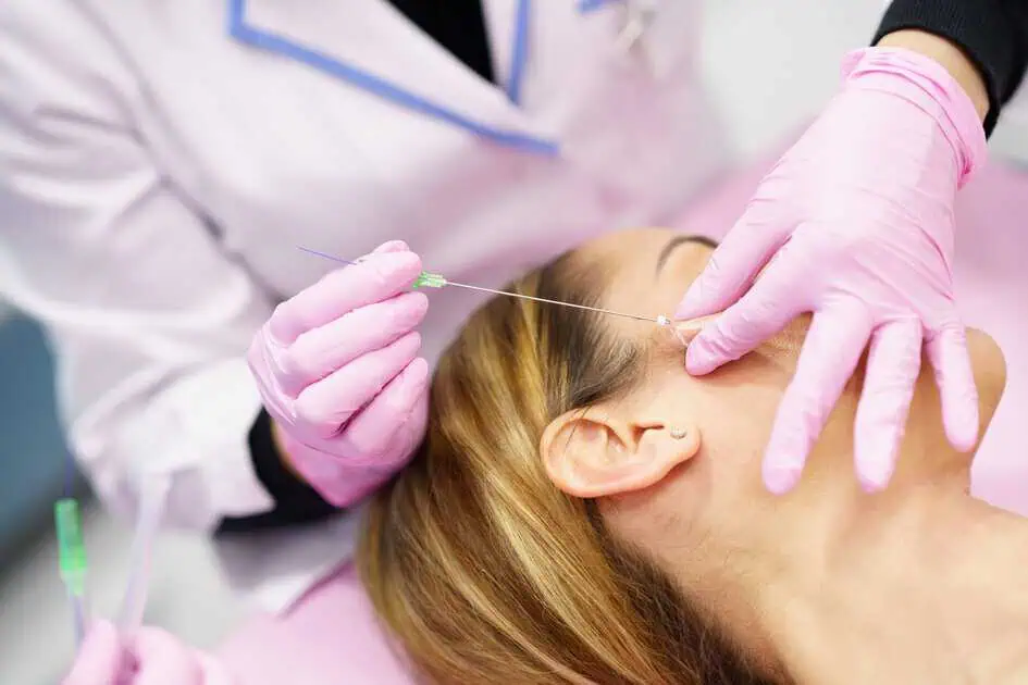 PDO Thread Lift by Dolce Vida Medical Spa in Connecticut